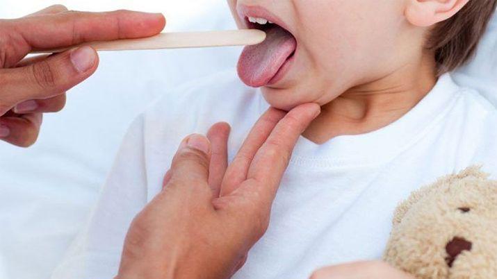 Todo lo que tienes que saber sobre la bacteria Estreptococo Pyogenes