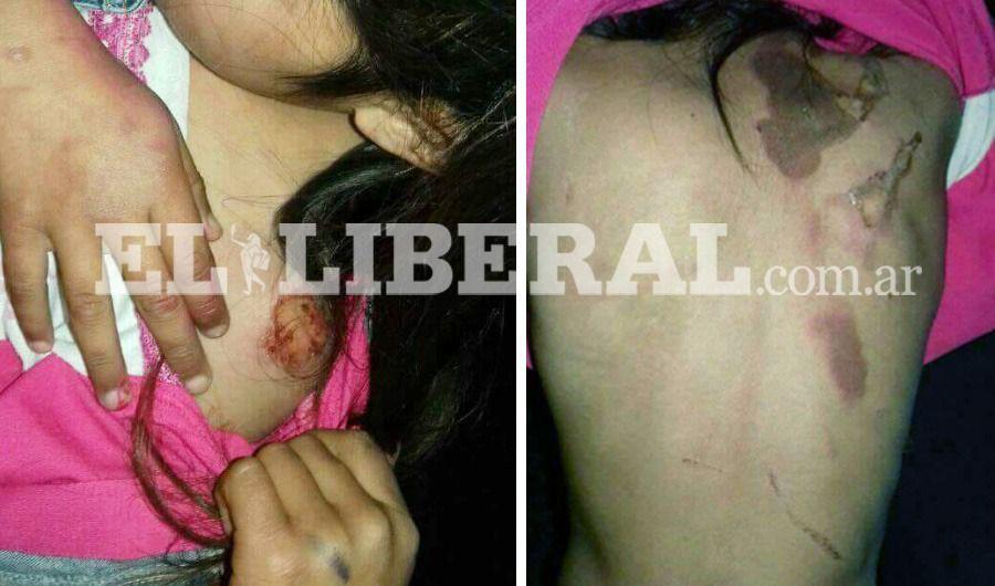 Horror- denuncian bestial maltrato a una nintildea por parte de su madre y su padrastro