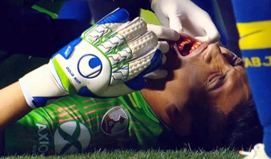 Video  Andrada sufrioacute una fractura de mandiacutebula y se pierde el superclaacutesico