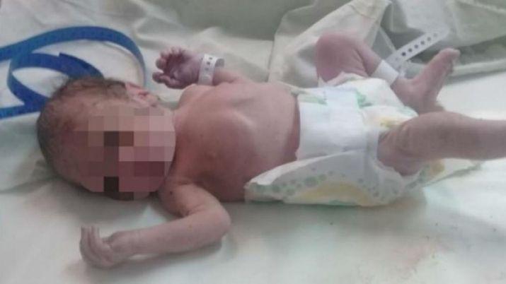 Reanimaron a un bebeacute que habiacutea sido abandonado en una bolsa