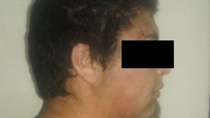 Un menor de 14 antildeos recibioacute un disparo en medio de un cumpleantildeos