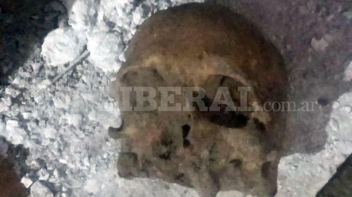 Impactantes imaacutegenes- encuentran restos oacuteseos en el Pasaje Castro