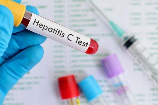 Se realizaraacute en nuestra ciudad un simposio sobre hepatitis virales