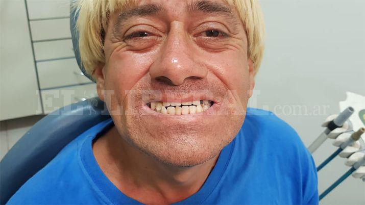 Coo el guarachero cada vez maacutes cerquita de tener la proacutetesis dental