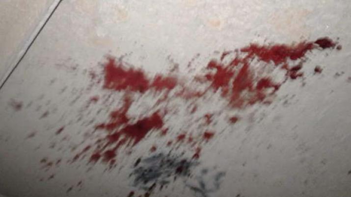 Buscan a un joven que golpeoacute a su esposa con un hierro en la cabeza