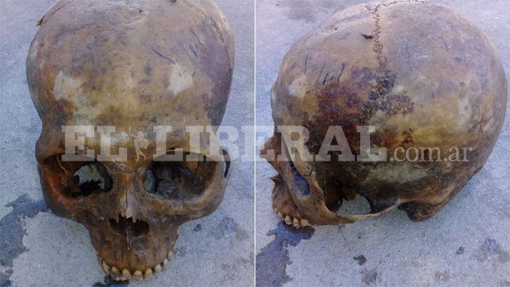 Vecinos de La Represa encuentran un craacuteneo humano