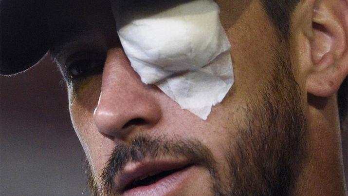 Pablo Pérez fue uno de los principales afectados por el ataque al colectivo de Boca