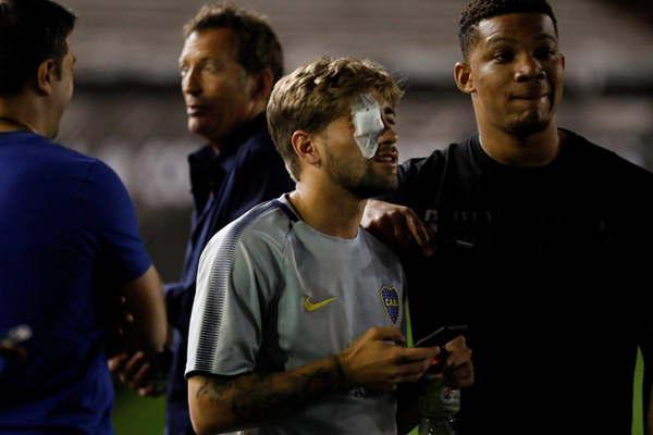 Boca trataraacute de hacer valer el reclamo 