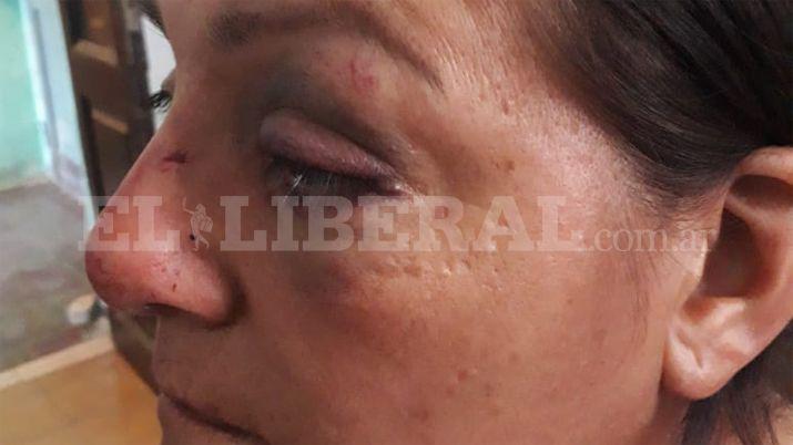 Quedoacute tras las rejas por brutal golpiza a su pareja