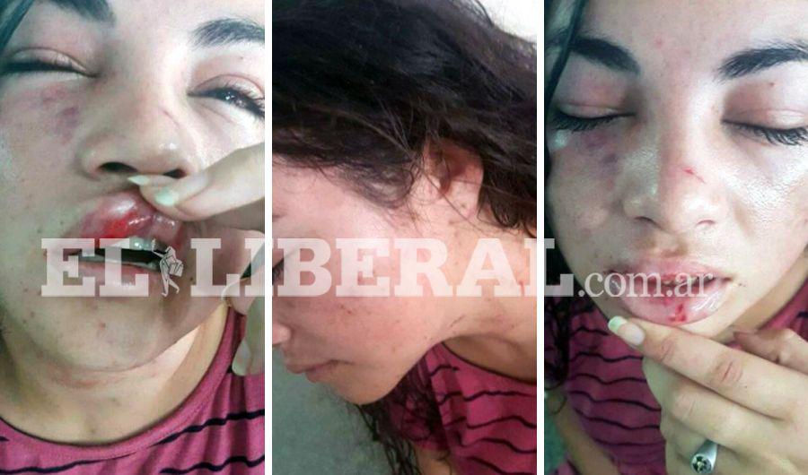 Detienen a un joven que agredioacute salvajemente a su novia