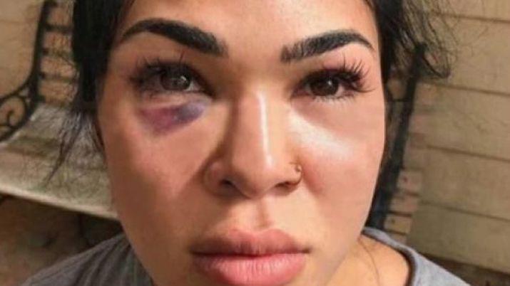 Desnuda se tiroacute por la ventana para huir de la violencia de su esposo