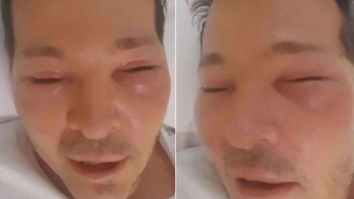 Guido Suumlller fue internado con el rostro desfigurado