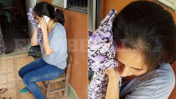 Le partieron la cabeza a una mujer para robarle