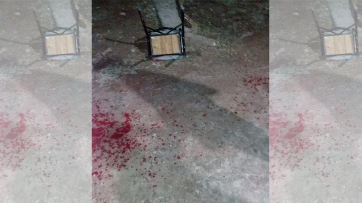 Pelea sangrienta entre dos jóvenes en Colonia Dora