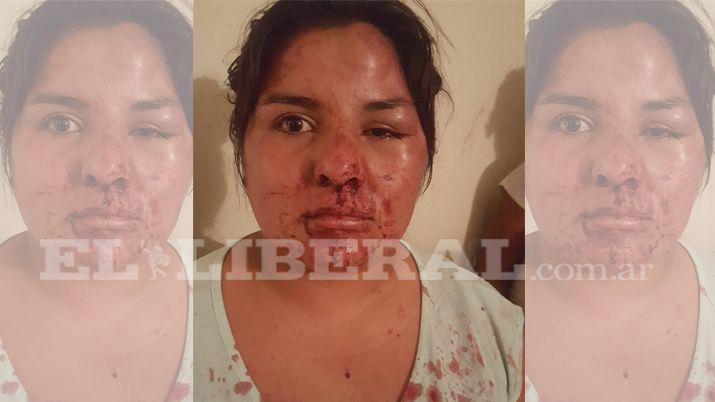 Se trenzó en una pelea con otras mujeres y casi la desfiguran