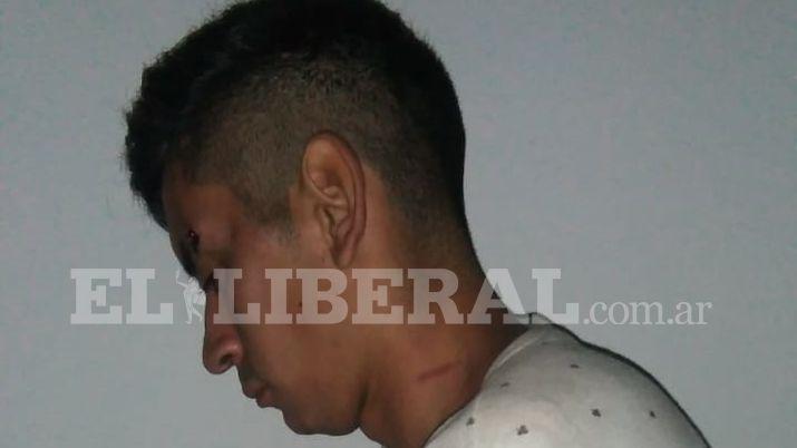 Le roboacute el celular en el boliche y lo atacoacute a arantildeazos hasta que llegoacute la policiacutea