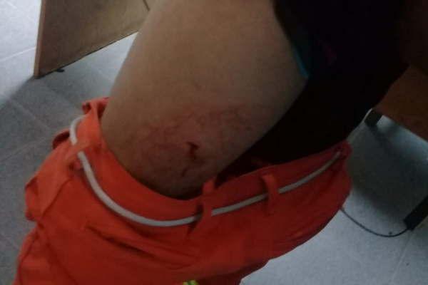 Empleado municipal se resistioacute a un asalto y uno de los ladrones lo acuchilloacute