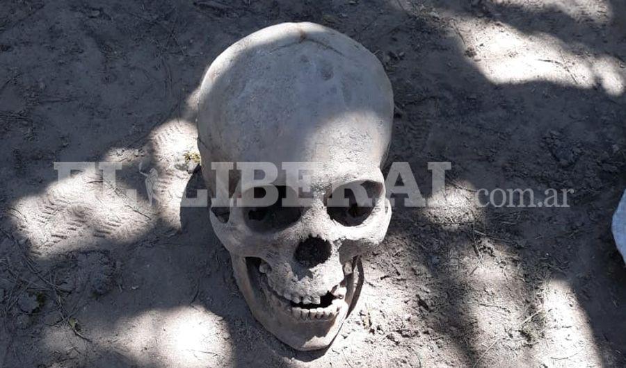 Un vecino encontroacute restos oacuteseos en el departamento Avellaneda