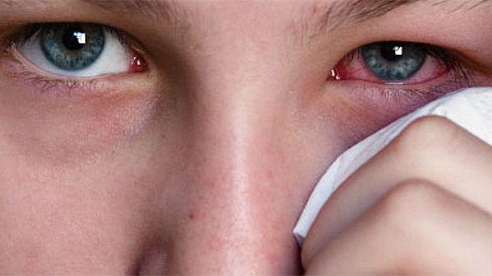 Alergias oculares de otontildeo