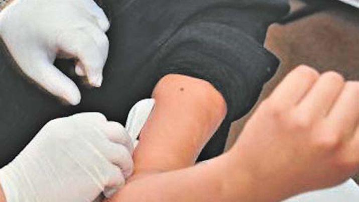 Colocaraacuten implantes subdeacutermicos gratis en diversas Upas