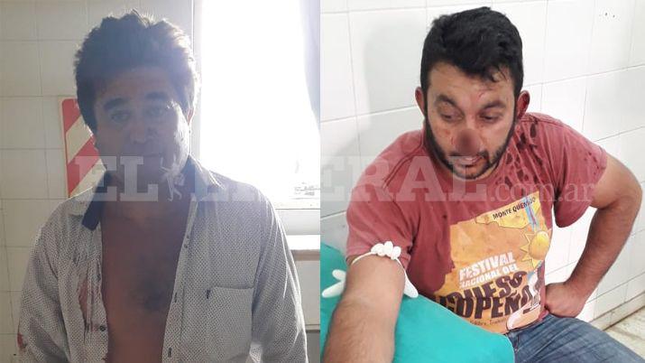 Monte Quemado- le mordioacute la nariz a su rival por el amor de una mujer