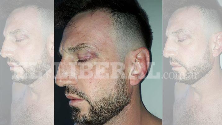 Comerciante que baleó a joven en finca se entregó a la Fiscalía