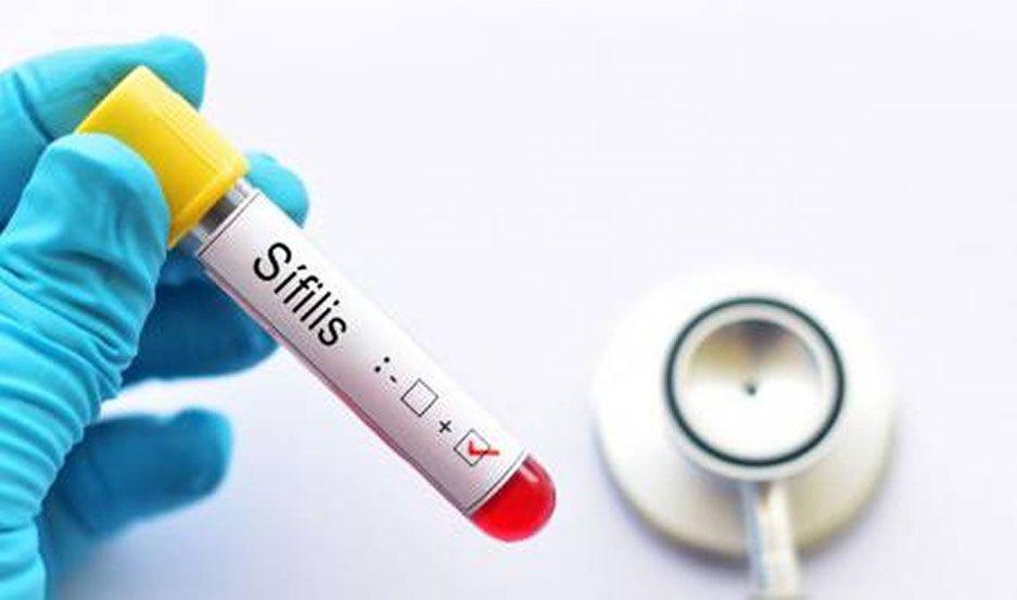 En apenas cuatro antildeos se triplicaron los casos de siacutefilis en Argentina