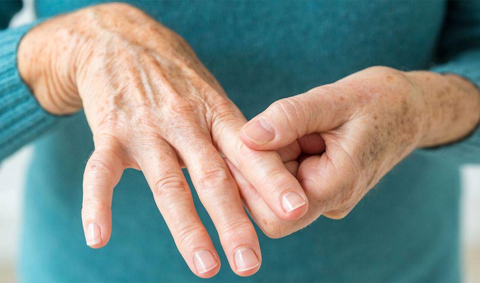 Realizaraacuten una campantildea de deteccioacuten gratuita de artritis reumatoidea