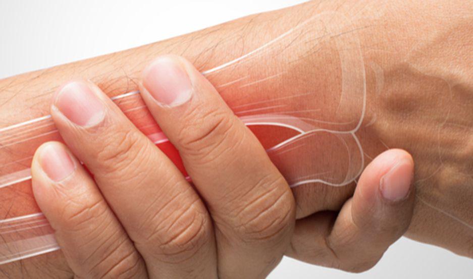 Ms de 8 mil santiagueños podrían tener artritis reumatoidea