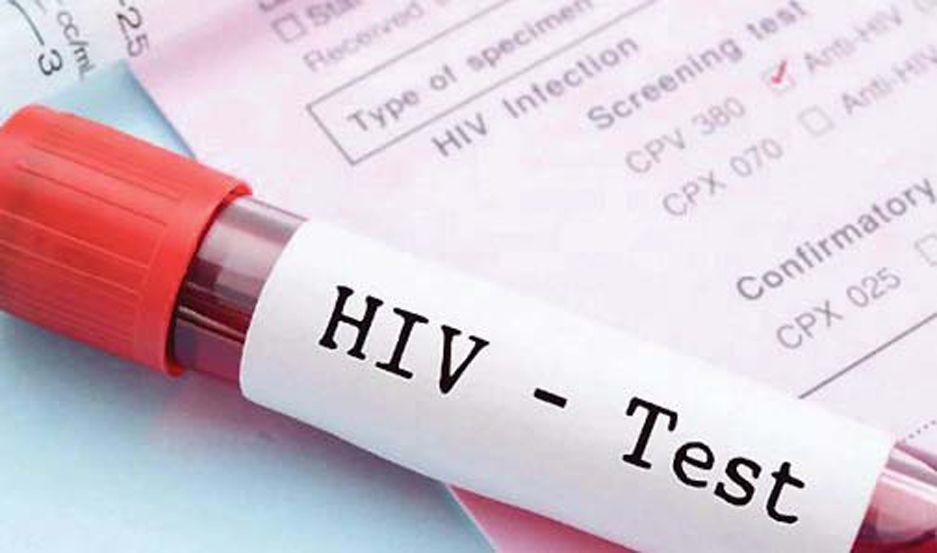 El diagnoacutestico a tiempo mejora la calidad de vida de las personas con VIH