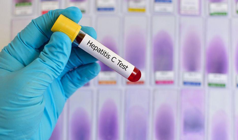 Se realizaraacute una campantildea de deteccioacuten raacutepida de hepatitis