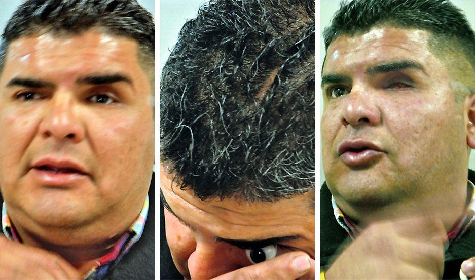 Ex remisero se sacoacute un ojo y lo mostroacute en plena audiencia frente a sus agresores