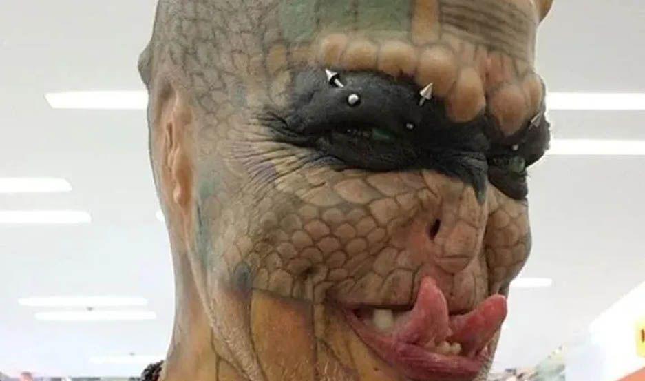 Impresionantes imaacutegenes  Hombre se operoacute muacuteltiples veces para convertirse en serpiente