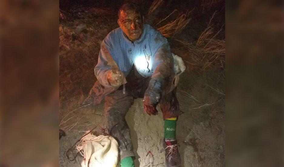 Un hombre de 63 antildeos luchoacute contra un puma para salvar a su perro