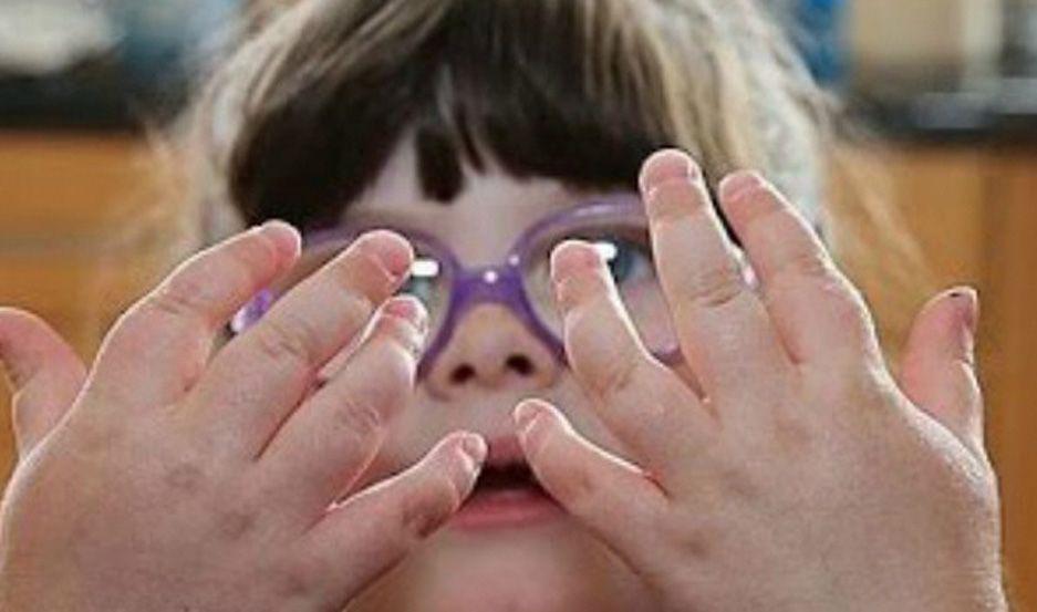 Piden a los padres estar atentos a los primeros siacutentomas de la artritis reumatoidea infantil