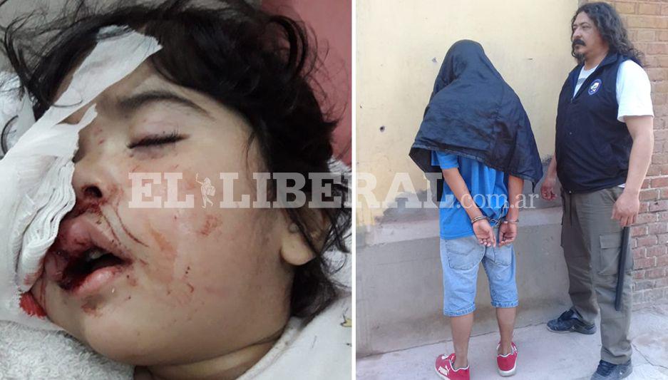Allanan una vivienda y detienen al joven que hirioacute con un ladrillo a una nena de dos antildeos