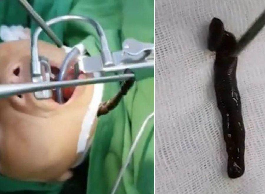 Tosioacute sangre durante 10 diacuteas por algo desagradable