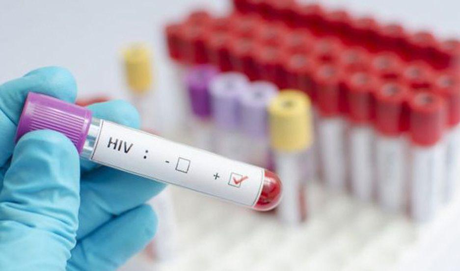 Aseguran estar maacutes cerca de encontrar una cura para el VIH