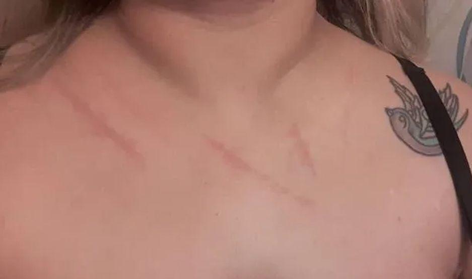 Suegra tuvo un brote psicoacutetico y acuchilloacute a la ex novia de su hijo