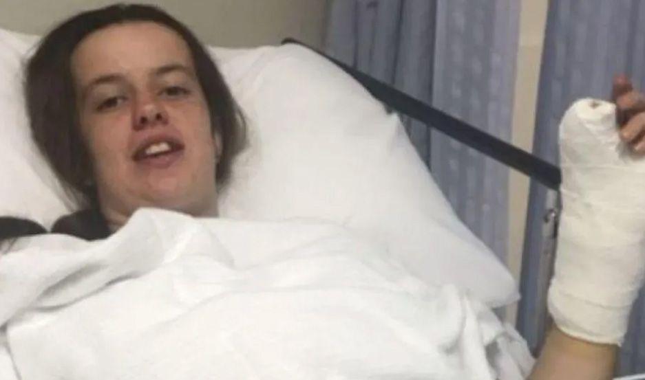 Por un error terminoacute con el pulgar del pie en la mano