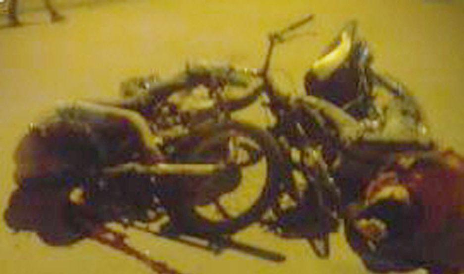 Motociclistas heridos en terrible choque en Campo Gallo