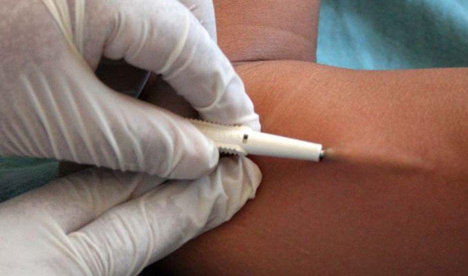 Mantildeana colocaraacuten los implantes subdeacutermicos anticonceptivos gratis