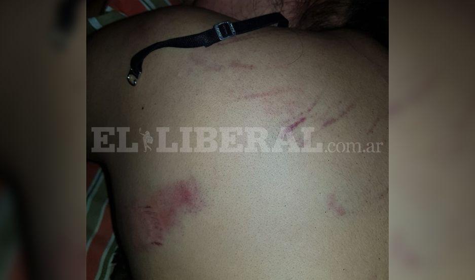 Las marcas evidencian la violencia del episodio