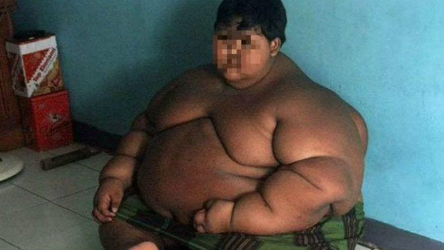 Increiacuteble cambio fiacutesico del nintildeo maacutes obeso del mundo