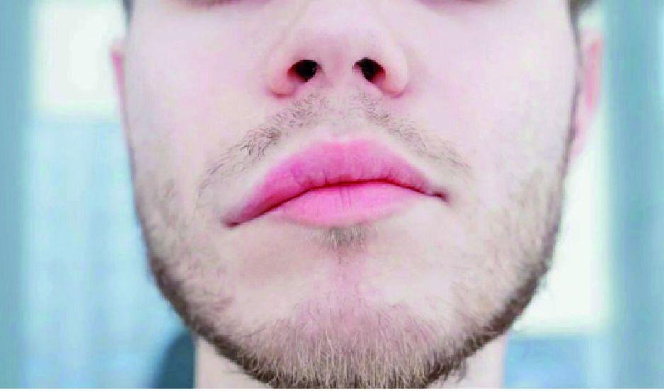 Afirman que se podraacute detectar un ACV con un celular