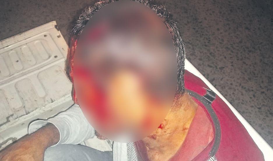 Mendoza fue asistido bañado en sangre y casi al borde del desmayo Antes había peleado con su
hermano y terció su hijo