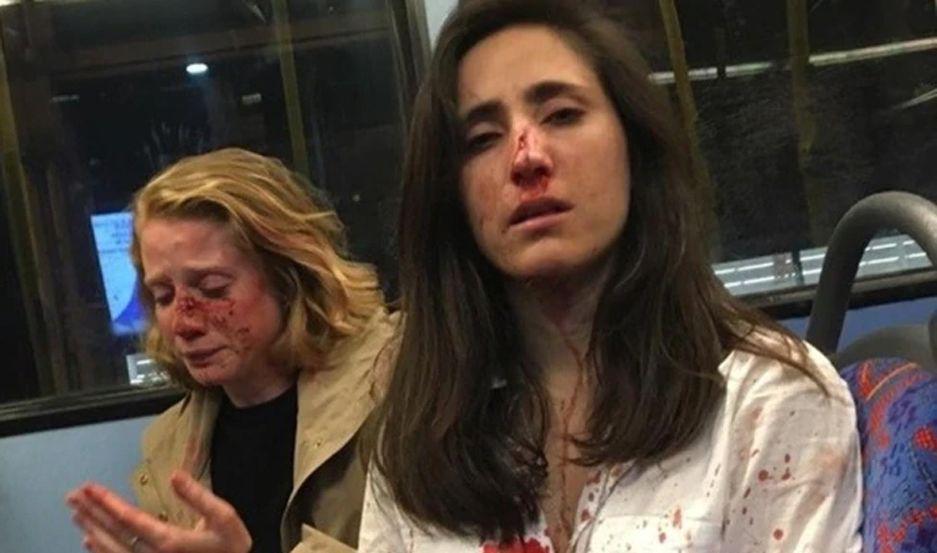Difundieron por primera vez las imaacutegenes del ataque a una azafata y su novia en Londres