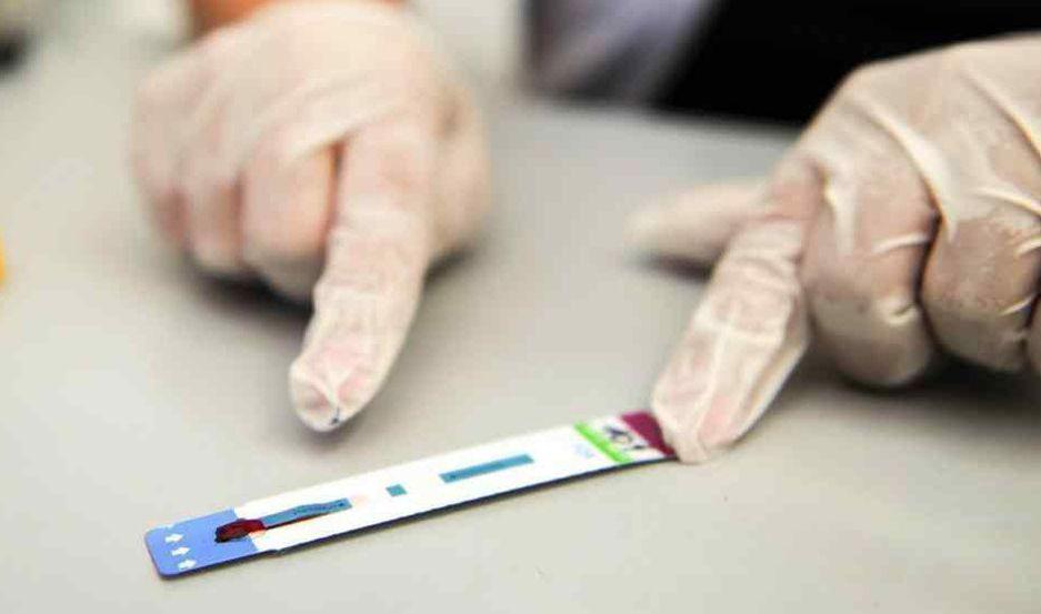 La Secretariacutea de Gobierno de Salud difunde el test de VIH para reducir el diagnoacutestico tardiacuteo de la infeccioacuten