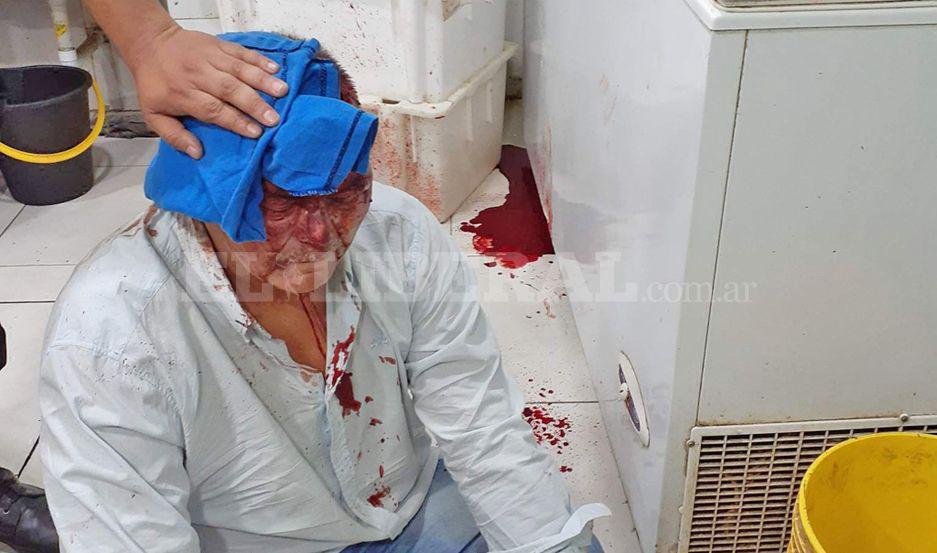 Reducen maniatan y golpean con un hierro al duentildeo de una carniceriacutea para llevarse 240 mil