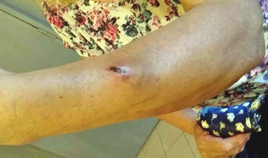 La mujer presenta una herida cortante en el brazo